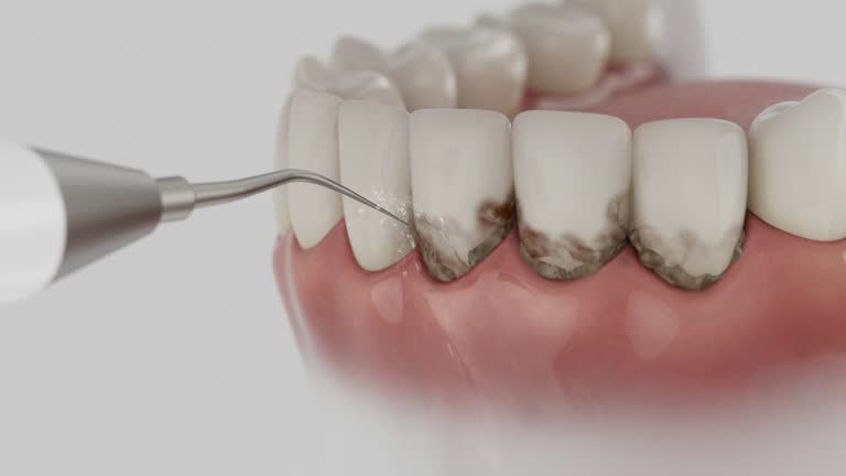 Reliable Emergency Dentist contractor in Chevy Chase, MD by Smile Center Dentistry